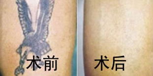 十大激光器排名是什么?(图5) 十大激光器排名是什么?(图5)